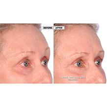 Active Argan 2-pack Resurface Super Size Resurfacing Serum