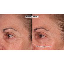 Active Argan Renew Retinol 2-Step Beauty Treatment Auto-Ship®