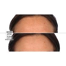 Active Argan Resurface Accelerating Peel Auto-Ship®