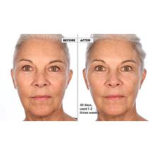Active Argan Resurface Accelerating Peel