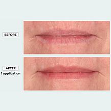 Active Argan Resurface Lip Treatment Balm - Auto-Ship®