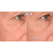 Active Argan Resurface Super Size Resurfacing Serum Auto-Ship®