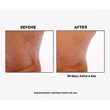 "As Is" BeautyBio GloPRO Skin Tool for Face & Body