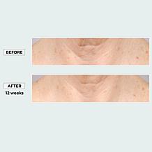 "As Is" Sharper Image Revel LED Light Therapy Neck & Décolletage Mask