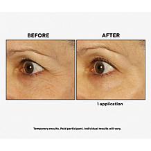 BeautyBio (2) 15-pair Packs Bright Eyes Gels