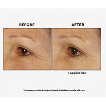 BeautyBio Eyelighter Concentrate & Bright Eyes Gels Auto-Ship®