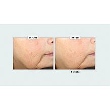 Beekman 1802 Dream Booster Skin Care Serum 3-Pack