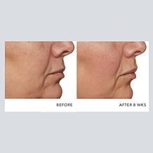 Beekman 1802 Milk RX Advanced Better Aging Cream 2-pack