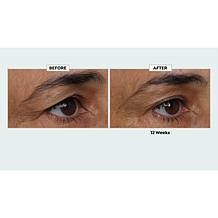 Beekman 1802 Milk RX Better Aging Dual Eye Treatment 2-pack