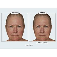 Beekman 1802 Potato Peel Milk Facial