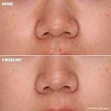 Benefit Cosmetics All You Knead is Pore Care Foaming Cleanser/Mask Duo