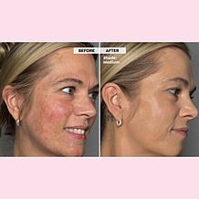 Doll 10 Peptide Bounce Foundation Set with Bag - Deep/Rich AS