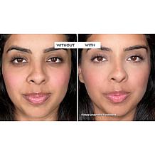 Doll 10 Treatment Concealer 2-pack with Applicator Sponge