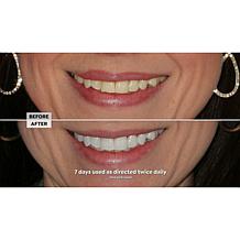 Intelliwhite Platinum Whitening Pen - Peppermint