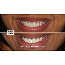 Intelliwhite Platinum Whitening Pen - Peppermint