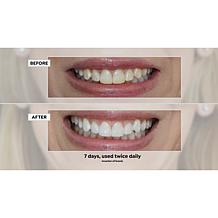 Intelliwhite Prostrips 14-Treatment Vanilla Creme Teeth Whitening Kit
