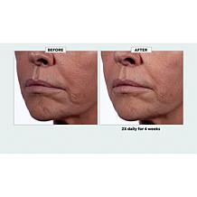 Isomers 14% Azelaic Acid Booster Complex