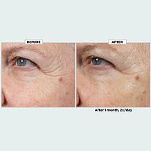 Isomers Matrixyl Serum and Copper Peptide Serum