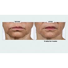 Isomers Retiniacin Night Renewing Treatment Serum