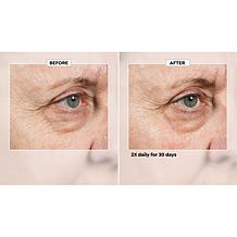 Isomers Skincare Bonus Size Multi-Corrective Eye Serum