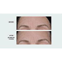 Isomers Skincare Expression Lines Peptide Booster Wrinkle Serum