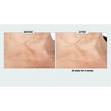 Isomers Skincare Matrixyl Hydration Boost Cream