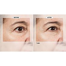 Isomers Skincare Matrixyl Hydration Boost Cream