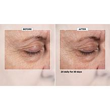 Isomers Skincare Multi-Corrective Fast Acting Eye Serum