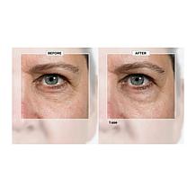 Isomers Skincare Next Youth Face and Eye 2-piece Set