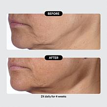 Isomers Skincare Special Edition Matrixyl Peptide Holiday Gift Set