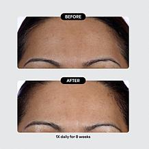 Isomers Skincare Special Edition Problem Solvers Holiday Gift Set