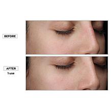 Kate Somerville ExfoliKate Jumbo Size Intensive Daily Cleanser