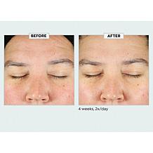 Kate Somerville KateCeuticals SuperCell Serum