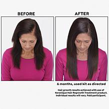 Keranique 120 Day Hair Regrowth 6-piece Bundle