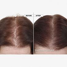 Keranique 120-Day Hair Regrowth Bundle Auto-Ship®