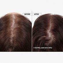 Keranique 120 Day Hair Regrowth Bundle