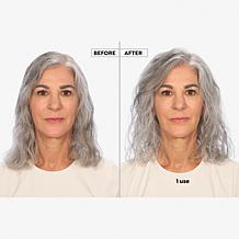 Keranique 120 Day Hair Regrowth Bundle