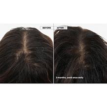 Keranique 120-Day Hair Regrowth Foam System with Scalp Massager AS