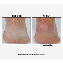 Korres Mega-size ElastiSmooth Candied Lemon Body Butter 2-pack