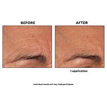 Korres White Pine Meno-Reverse Concentrate