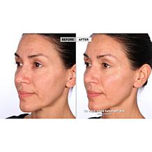 Lancôme Genifique Concentrate with Deluxe Sample