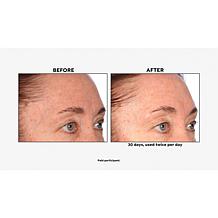 Lancôme Genifique Home & Go 2-piece Set