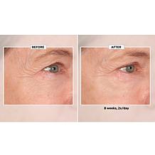 Lancôme Renergie Lift Multi Action Ultra Eye Cream