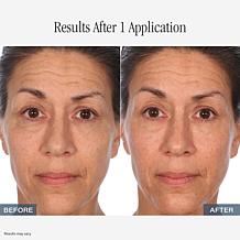 LUM OIL+LUMLIPOIL AS