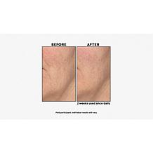 M. Asam Resveratrol NT50 Intensive Ampoules Beauty Treatment 2pk AS