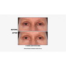 M. Asam Resveratrol NT50 Perfecting Eye Cream Auto-Ship®