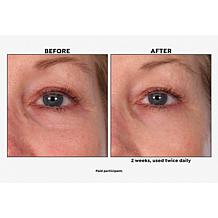 M. Asam VinoLift Skin Tightening Eye Balm 1.01 fl. oz.