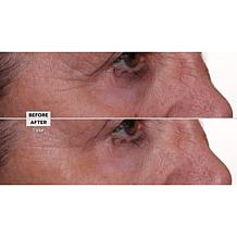 Nakery Beauty 2-pack Lift-TOX 360 Firming Eye Lift Treatment