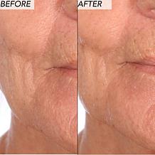 Nakery Beauty 2-Piece Supersize Firm + Lift Collection - Auto-Ship®