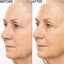 Nakery Beauty 2-Piece Supersize Firm + Lift Collection - Auto-Ship®